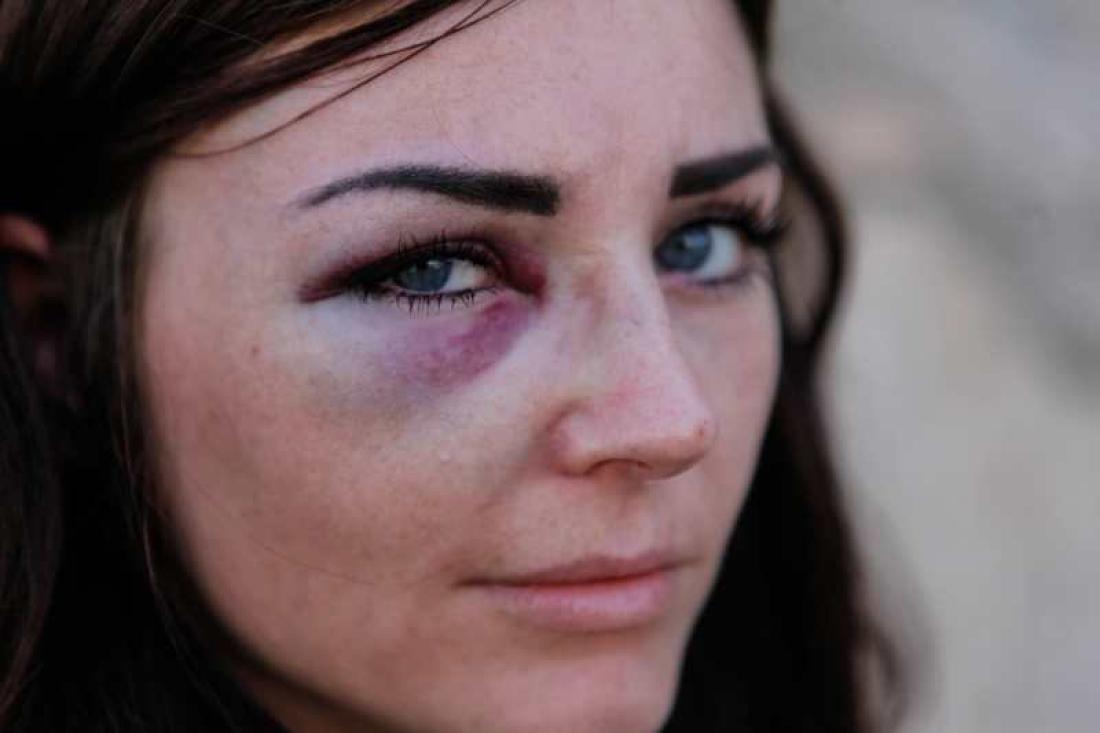 Renate ble slått i asfalten